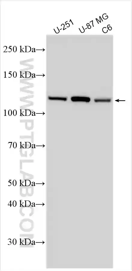 Vinculin antibody (66305-1-Ig) | Proteintech