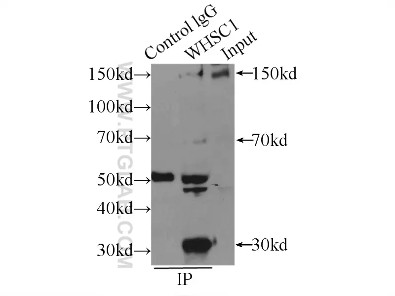 WHSC1 antibody (22722-1-AP) | Proteintech