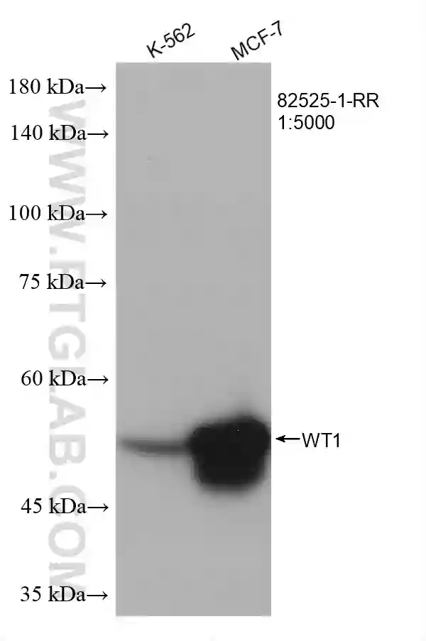 WT1 antibody (82525-1-RR) | Proteintech