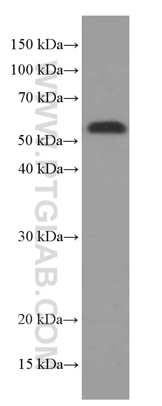 XRCC4 antibody (66621-1-Ig) | Proteintech