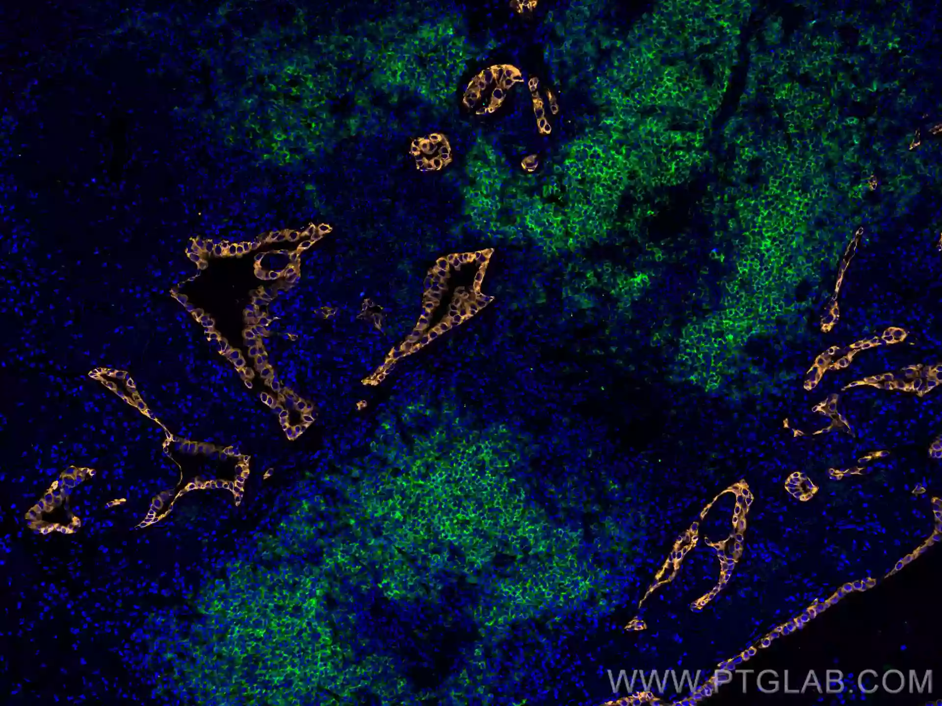 CD20 antibody (CL488-60271) | Proteintech