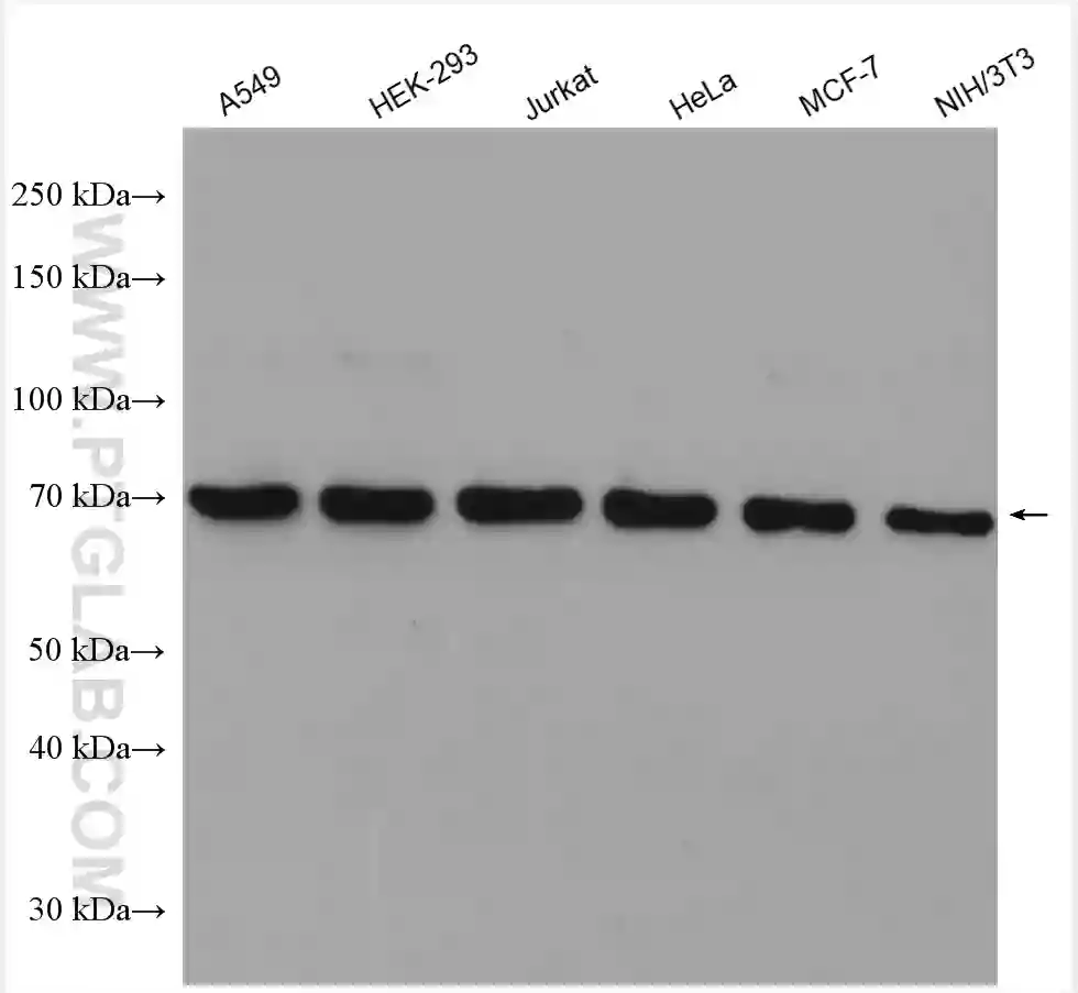 YTHDF1 antibody (17479-1-AP) | Proteintech