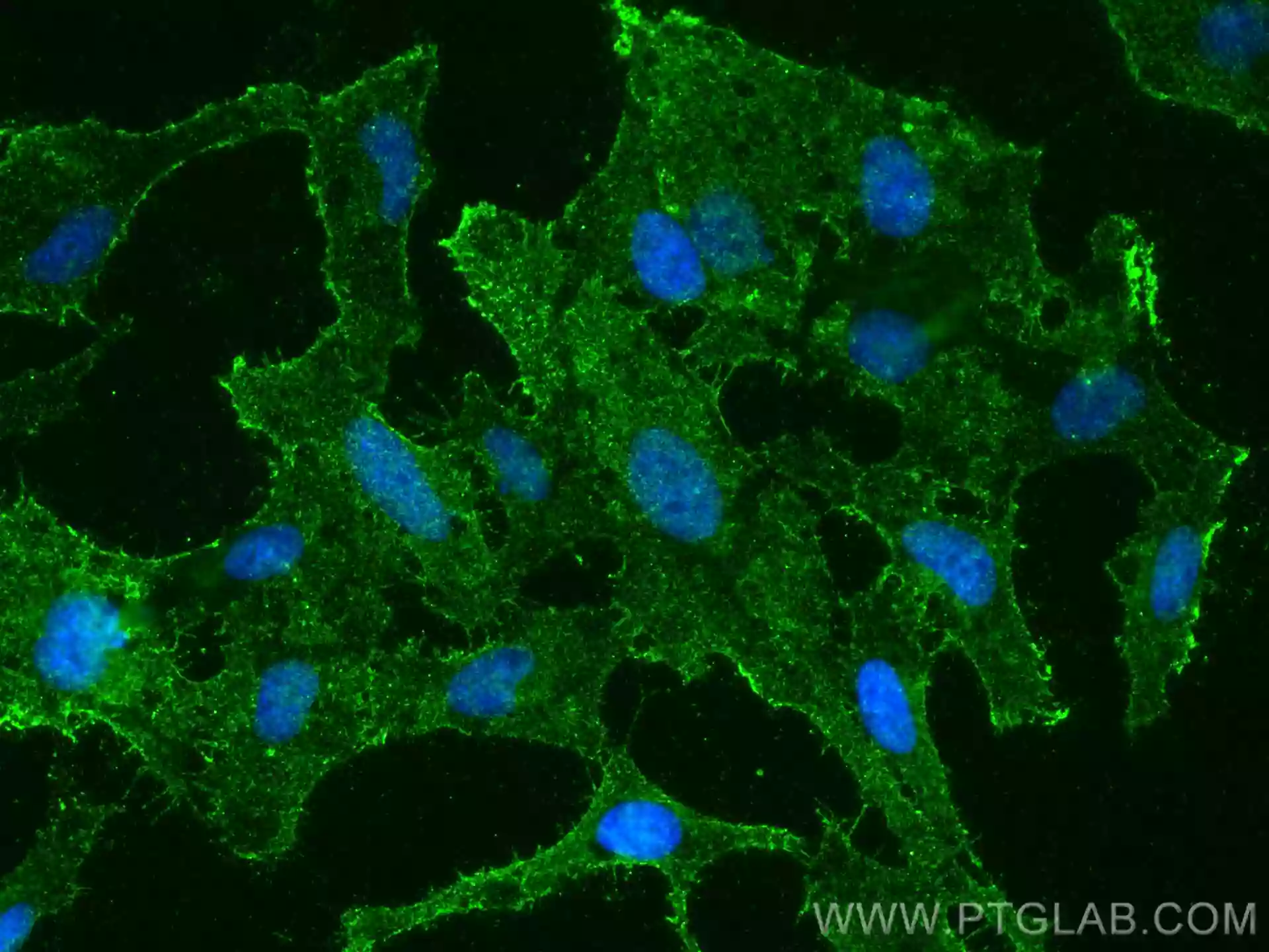 ZDHHC5 antibody (21324-1-AP) | Proteintech