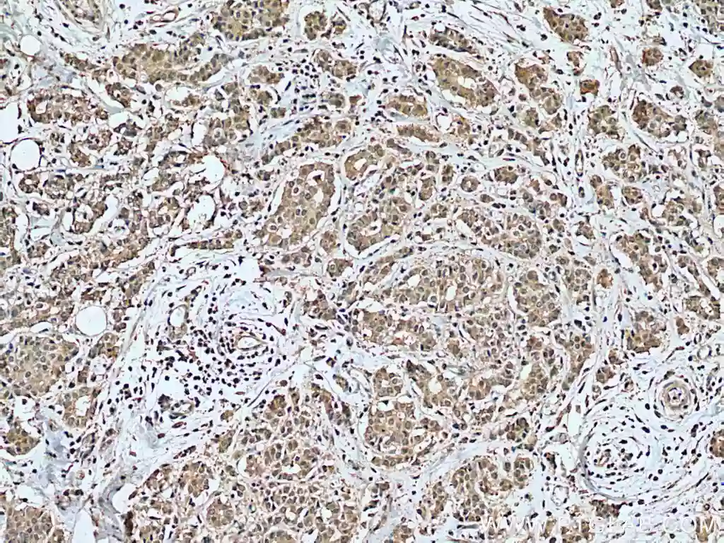 ZEB2 antibody (67514-1-Ig) | Proteintech