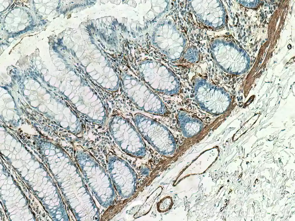 Immunohistochemistry staining of human colon using smooth muscle actin specific Recombinant antibody