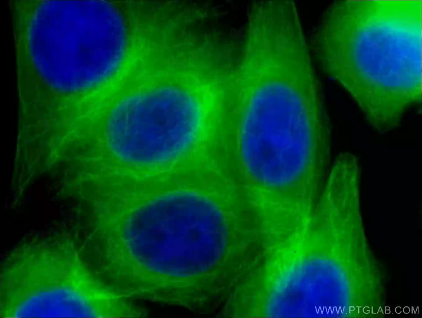 Beta Tubulin antibody CL488 66240 Proteintech