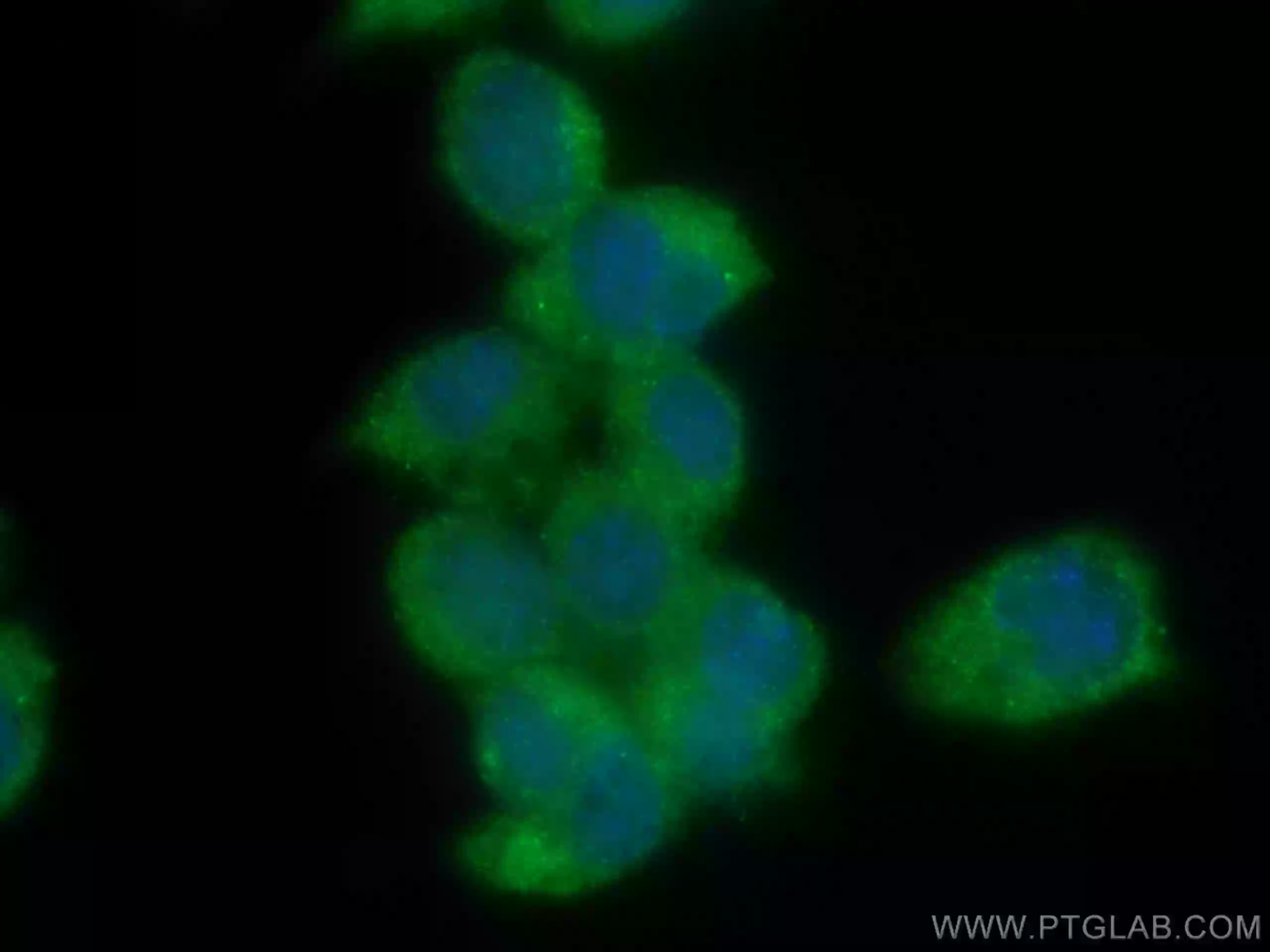 Chromogranin A antibody (60135-2-Ig) | Proteintech