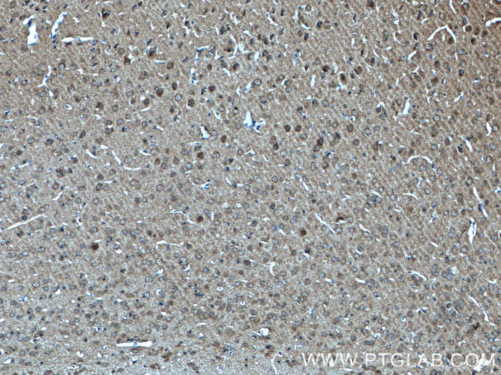 SNIP/p140Cap antibody (55362-1-AP) | Proteintech