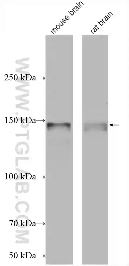 SNIP/p140Cap antibody (55362-1-AP) | Proteintech