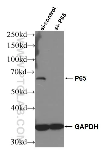 NF-κB p65 antibody (80979-1-RR)