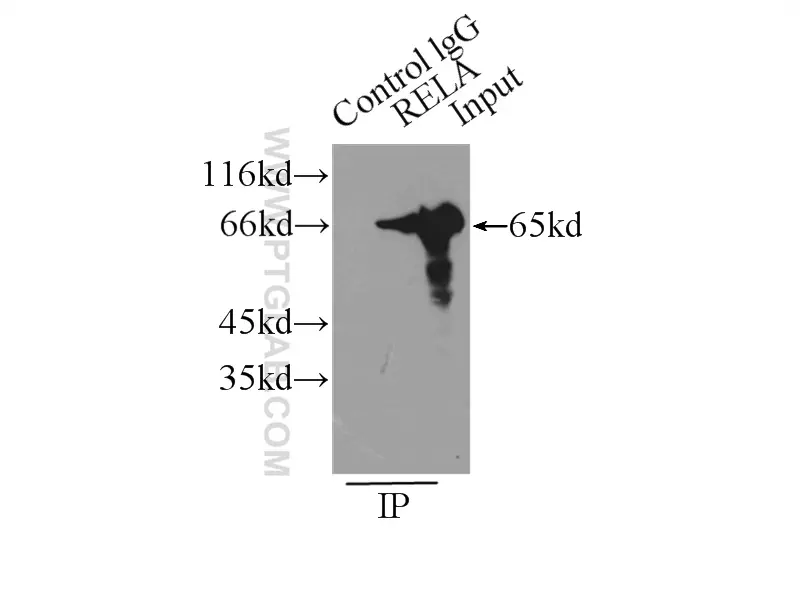 NF-κB p65 antibody (10745-1-AP) | Proteintech
