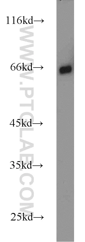 NF-κB p65 antibody (10745-1-AP) | Proteintech