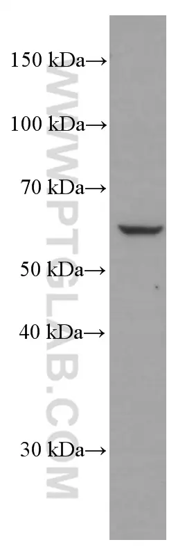 p70(S6K) antibody (66638-1-Ig) | Proteintech