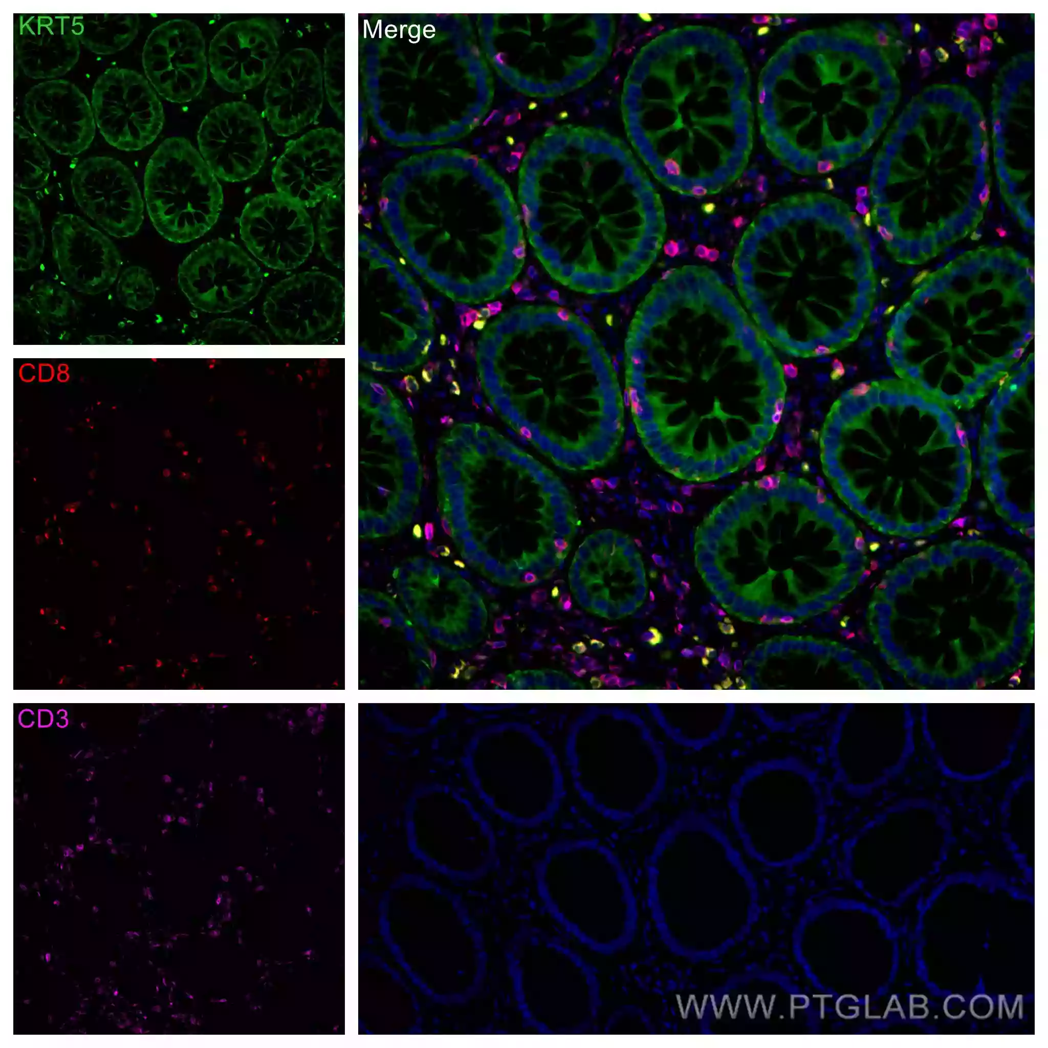 pan-keratin antibody (CL488-26411) | Proteintech