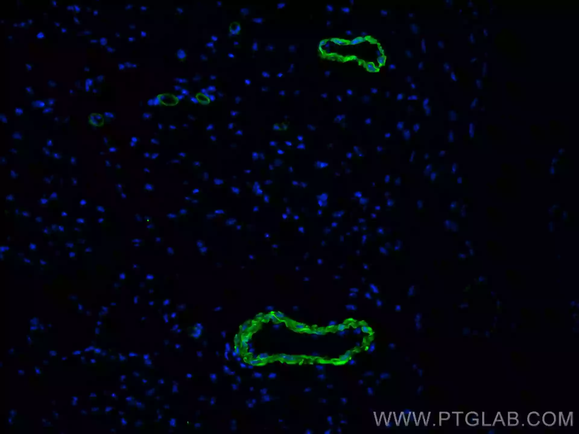 smooth muscle actin specific antibody (CL488-67735) | Proteintech