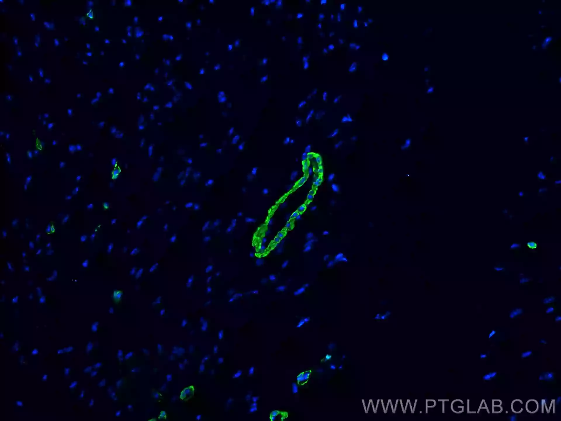 smooth muscle actin specific antibody (CL488-80008) | Proteintech