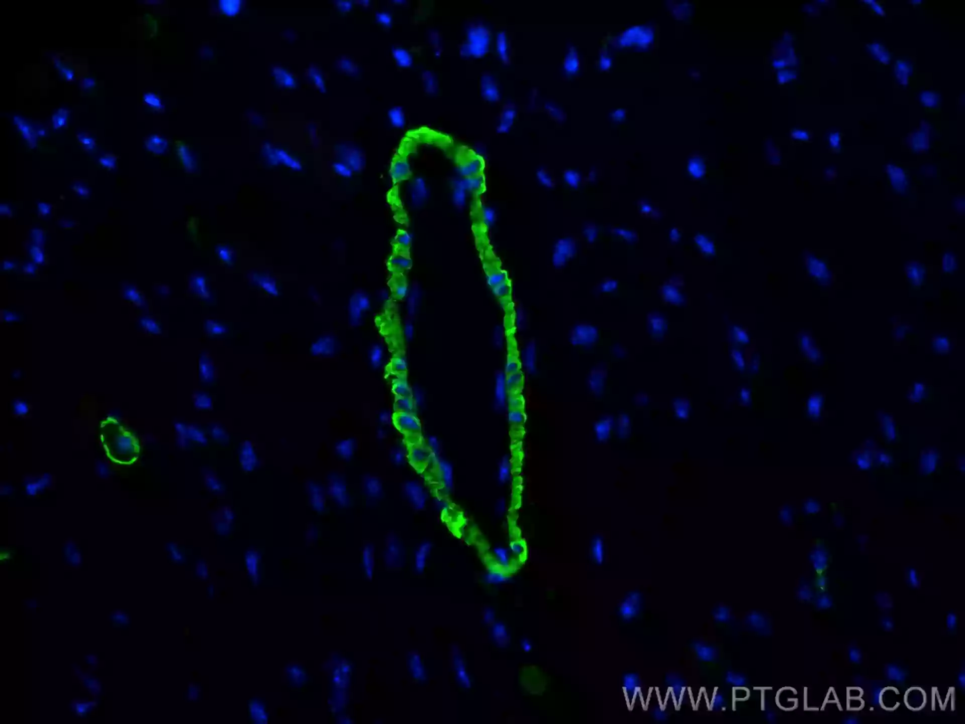 Immunofluorescence staining of mouse heart using CoraLite® Plus 488-conjugated smooth muscle actin specific Recombinant antibody