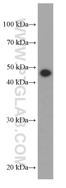 Gamma Tubulin antibody (66320-1-Ig) | Proteintech