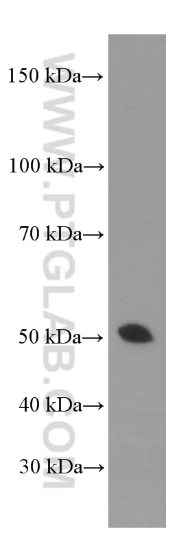 Gamma Tubulin antibody (66320-1-Ig) | Proteintech