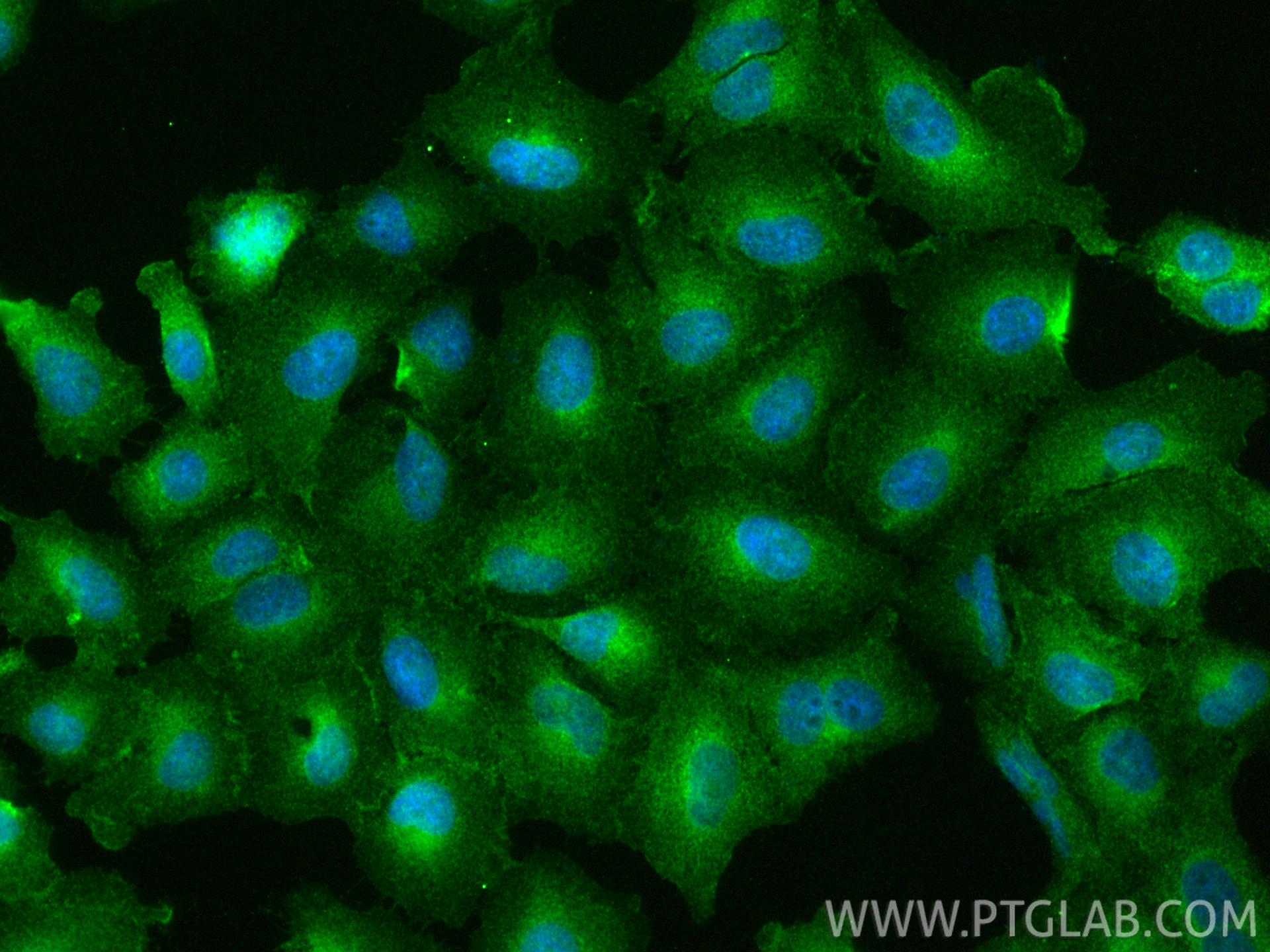 Immunofluorescence (IF) / fluorescent staining of A549 cells using SLC7A11/xCT Polyclonal antibody (26864-1-AP)